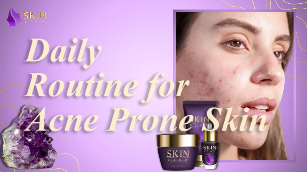 Daily Routine for Acne Prone Skin